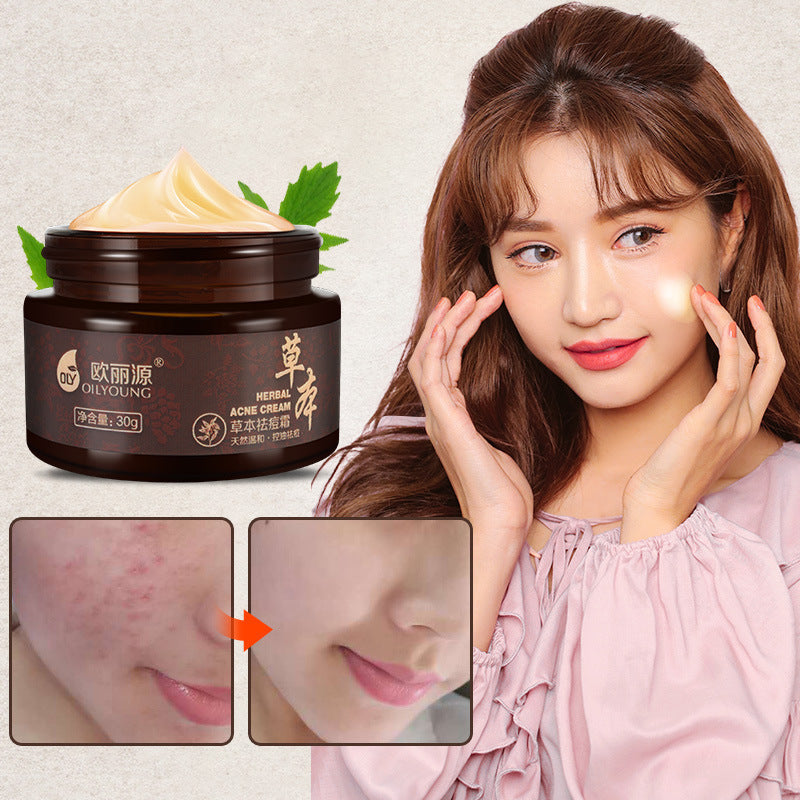 Closed mouth acne cream